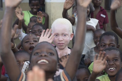 A picture of Annie Alfred at school - taken in Malawi. This photo is part of the Malawi campaign to stop the killings of people with albinism in Malawi.
