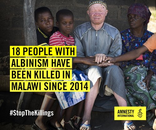 18 people with albinism have been killed in Malawi since 2014