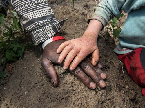 malawi20albinism20LAWILINKAmnesty20International_0.jpg